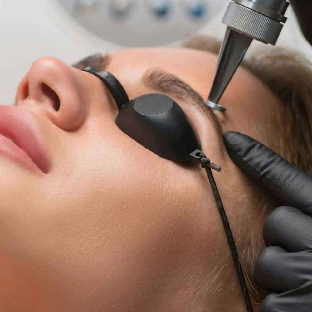 Tattoo Removal 4 Techniques Training
